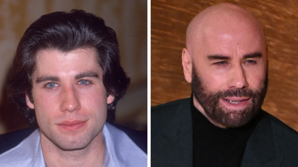 Side-by-side of John Travolta then and now