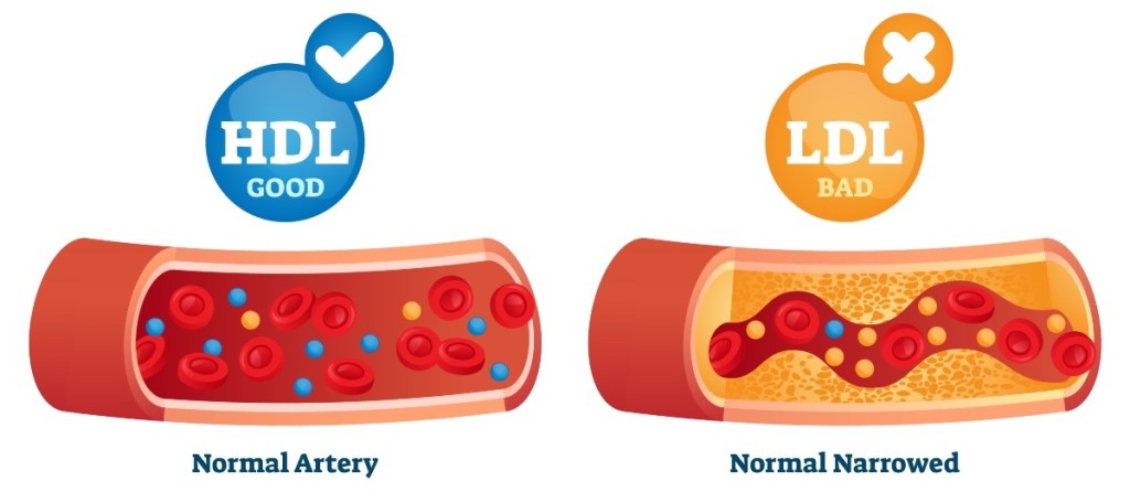 HDL and LDL cholesterol