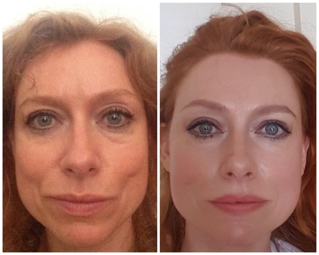 Mature woman before and after face yoga