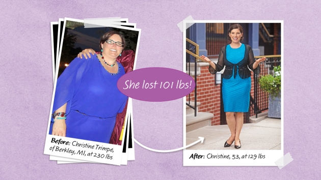before and after of Christine Trimpe, whose diet for fatty liver helped her lose 101 lbs