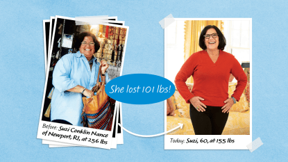 Before and after of Suzi Conklin Nance, who lost 101 lbs with hypnosis weight loss