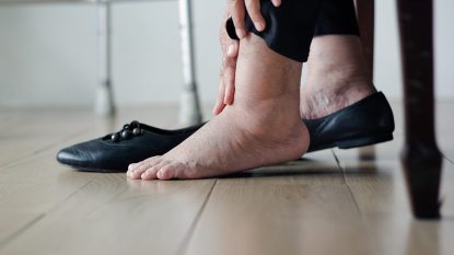 close up of swollen feet and ankles, mature woman taking off her black flat shoes