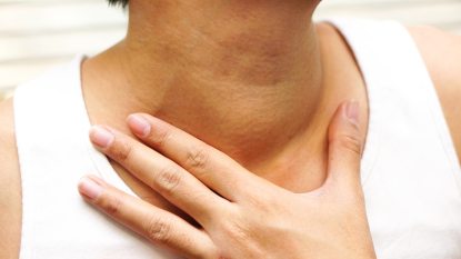 mature woman with her hand pressed to her neck, lump in her neck on her thyroid