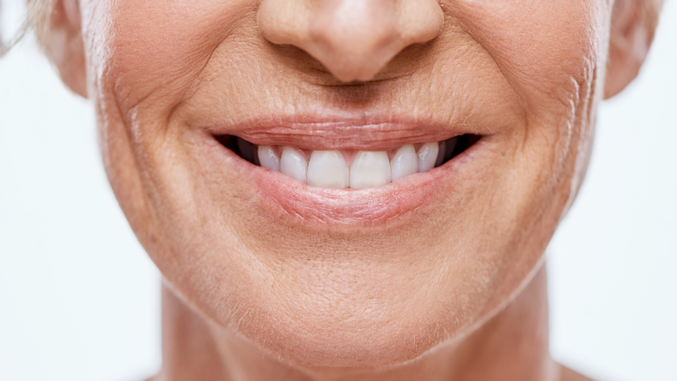 teeth-whitening-treatments