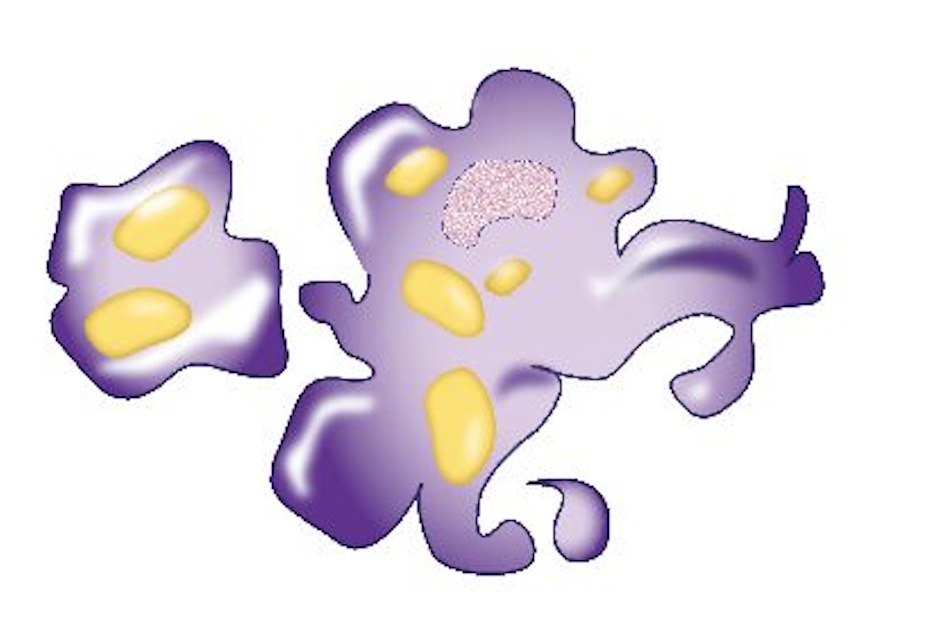 Diagram of destroyed fat cell