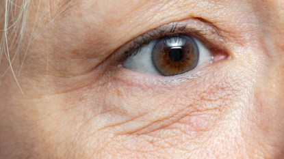 Extreme close up detail of under eye wrinkles and sagging skin on middle aged woman.