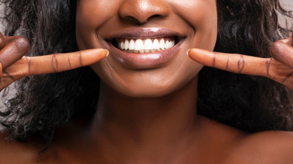 close up of woman with pearly white teeth smiling