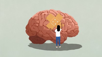 illustration of woman putting bandaid on brain, concept for memories rewire in mental health