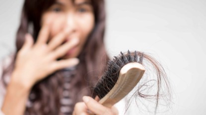 Woman shocked at hair loss, holding brush full of hair