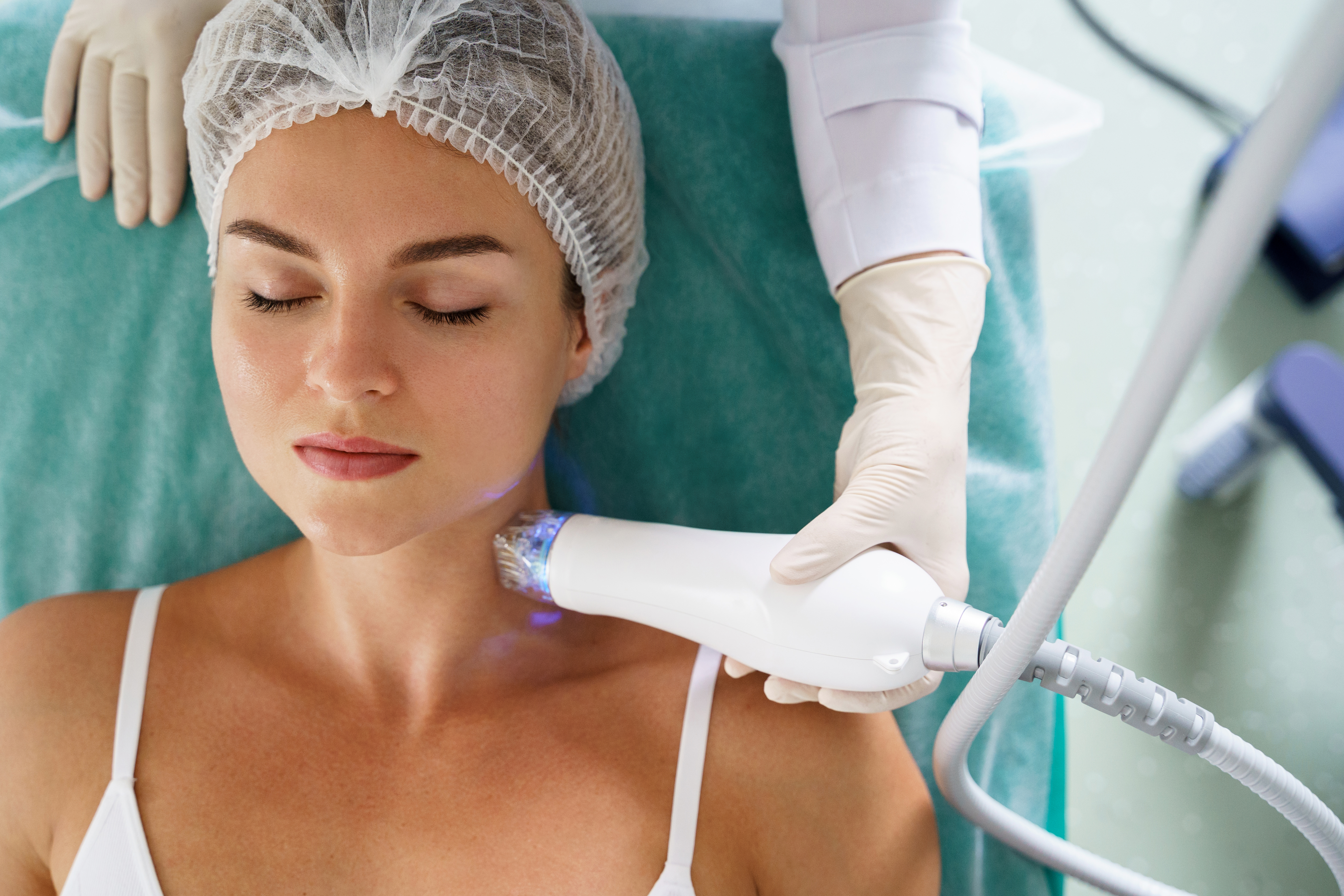 Woman getting a radiofrequency microneedling treatment to help combat a crepey neck