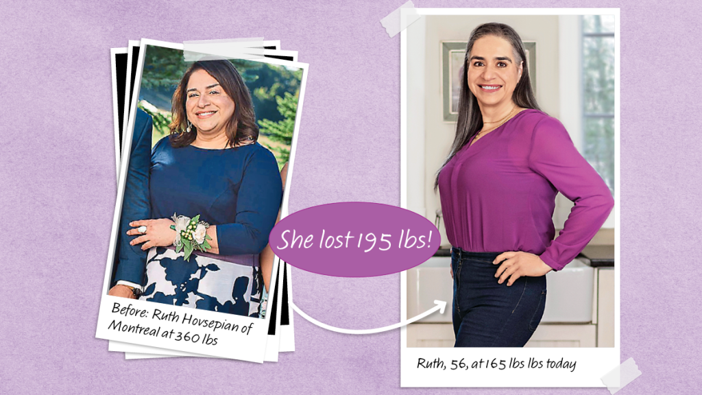 Before and after photos of a real life woman who lowered her uric acid levels and lost 195 pounds