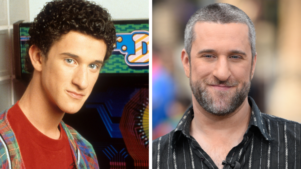 Dustin Diamond from the Saved by the Bell cast. Left: 1991; Right: 2016