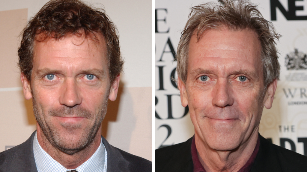 Hugh Laurie from the House cast. Left: 2004; Right: 2022