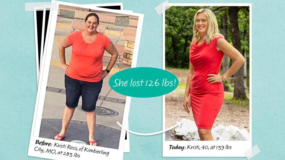 before and after photos of Kristi Ross, who lost 126lbs; Leaky gut symptoms