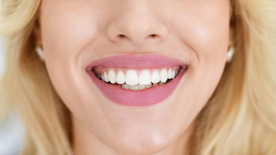 oil pulling benefits: Unrecognizable blonde lady showing beautiful white teeth after treatment, sitting at dental chair, cropped, panorama. Woman attending modern dental clinic, having teeth whitening treatment
