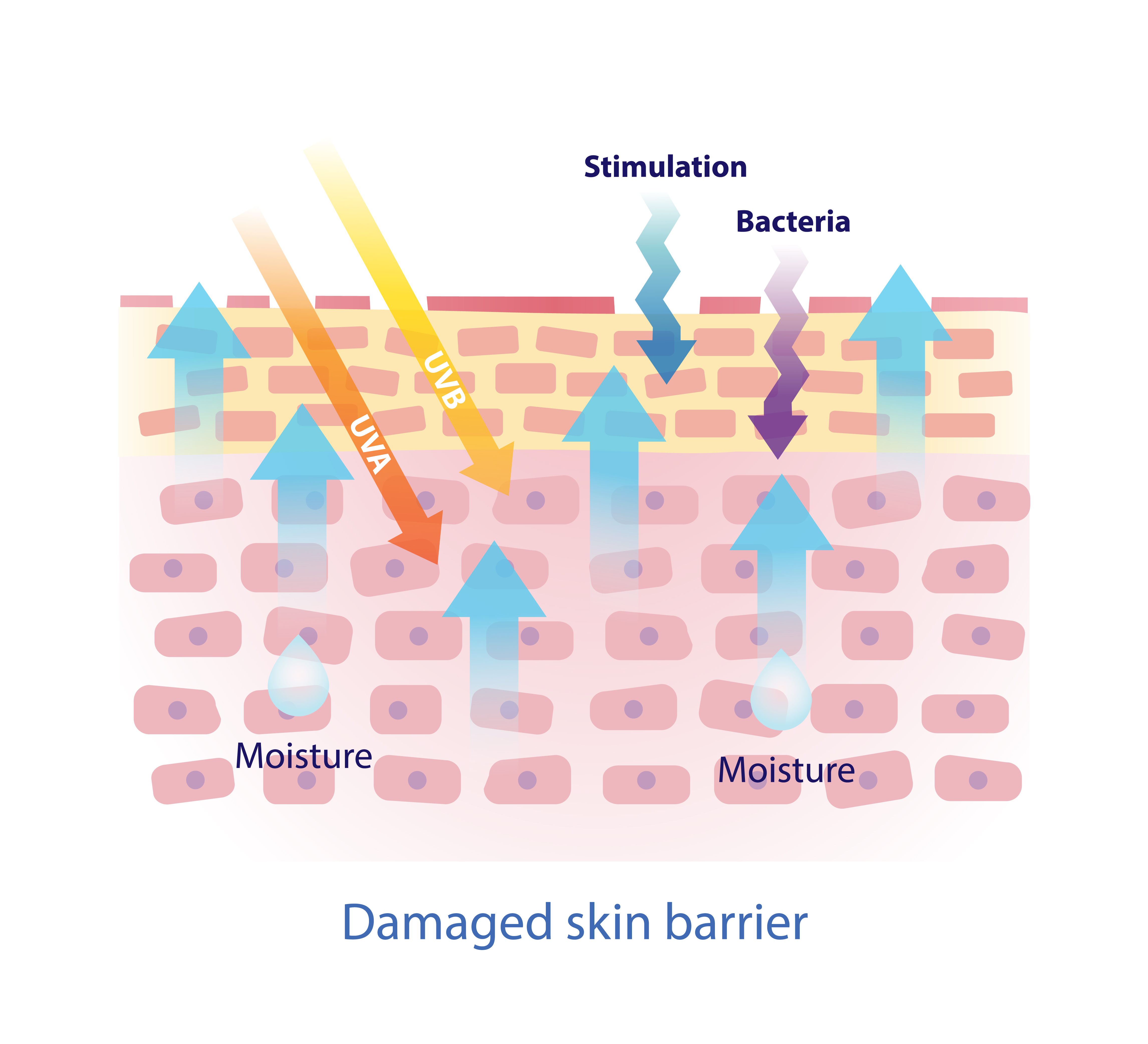 Illustration of a damaged skin barrier that needs skin barrier repair