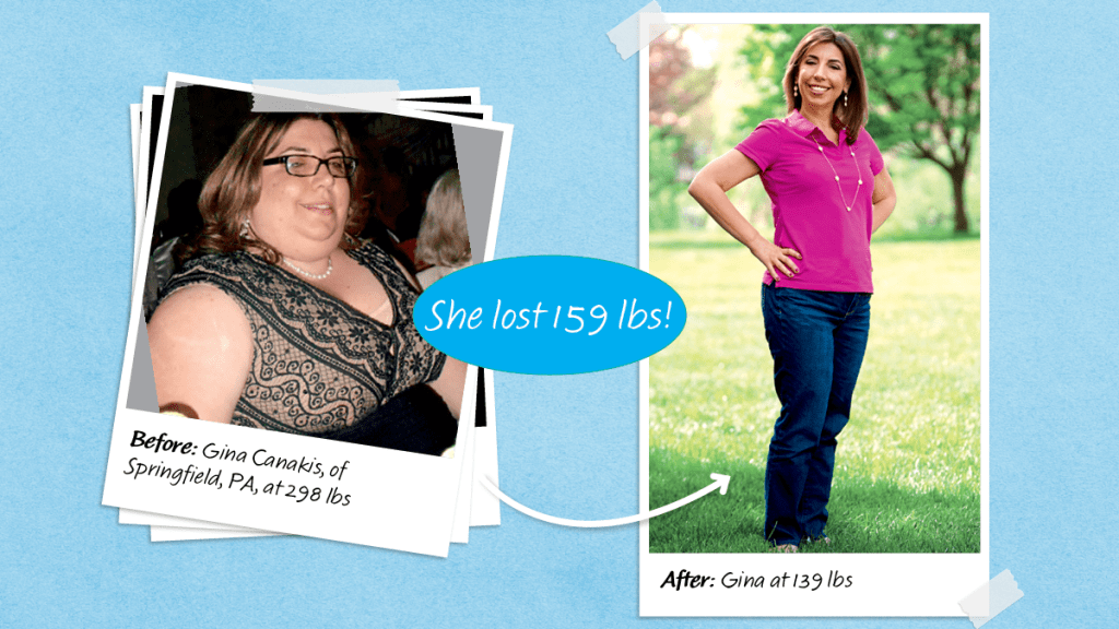 Before and after of Gina Canakis, who lost weight to avoid weight loss surgery