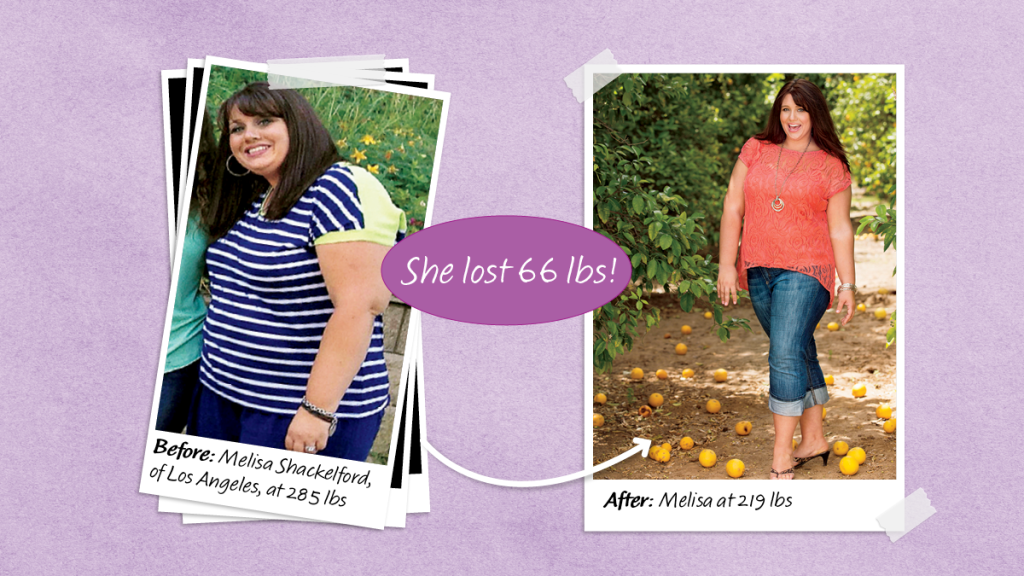 before and after of Melisa Shackelford, who lost weight to avoid weight loss surgery