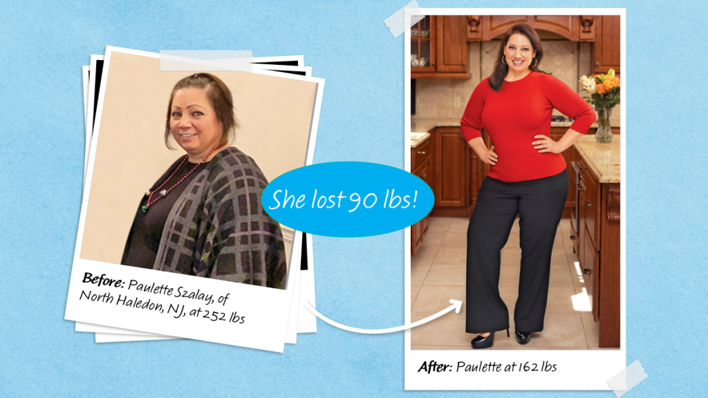 before and after of Paulette Szalay, who lost weight to avoid weight loss surgery