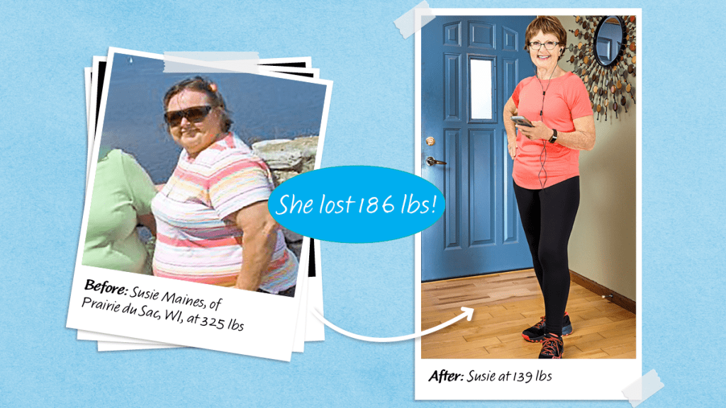 Before and after of Susie Maines, who lost weight to avoid weight loss surgery