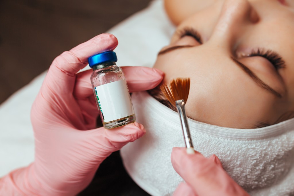 Woman getting a chemical peel done with the treatment being shown