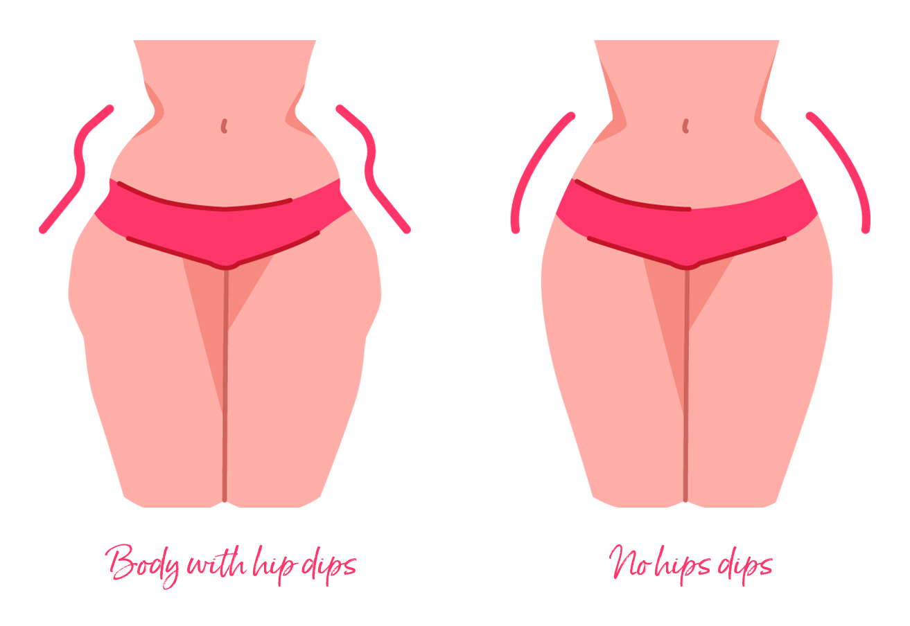 Does anyone else have this 'violin hips' body shape? How do you