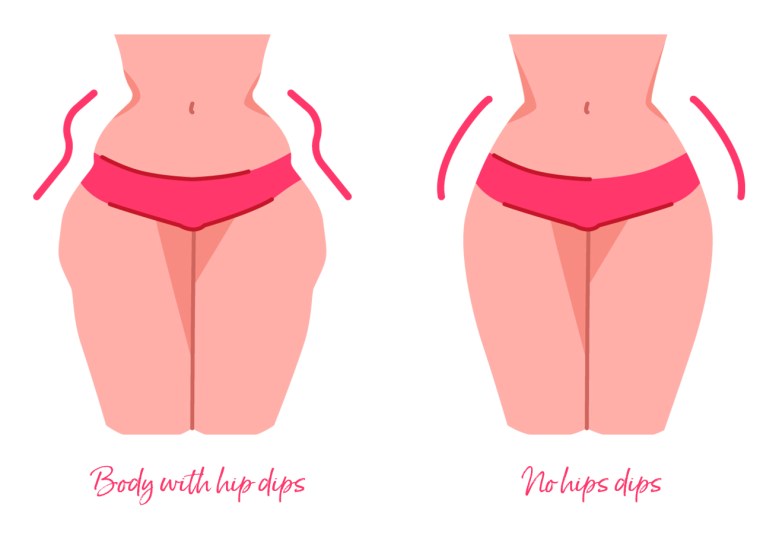 illustration of a body with hip dips and without