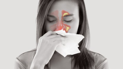 Woman with sinus infection highlighted on her face as she blows her nose
