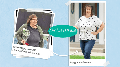 Peggy Herrick, who lost 135 lbs on liver-detoxing foods
