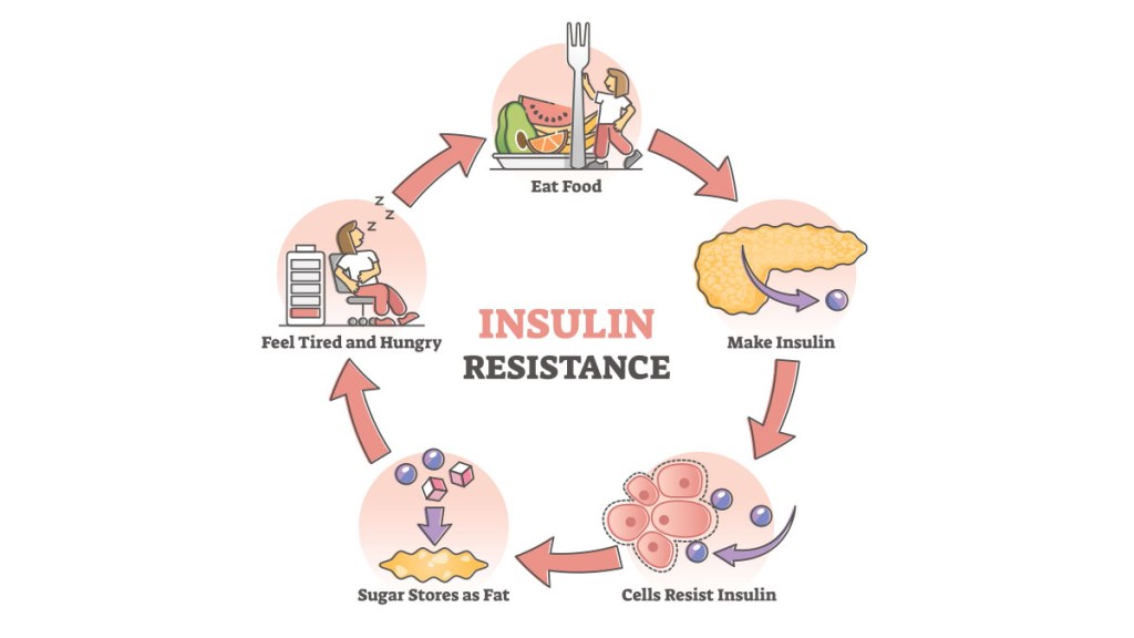 Insulin resistance medical graphic