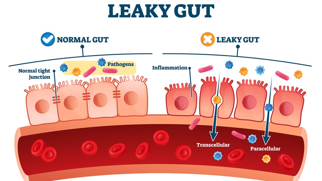 Illustration showing the way your gut lining can become "leaky" when exposed to emulsifiers
