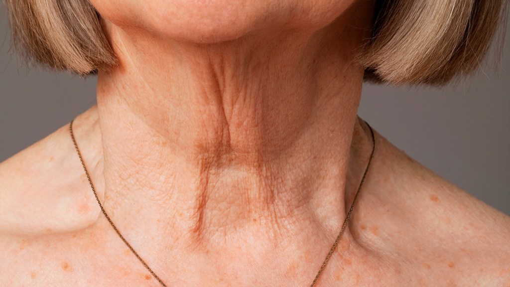 Close up of crepey neck skin