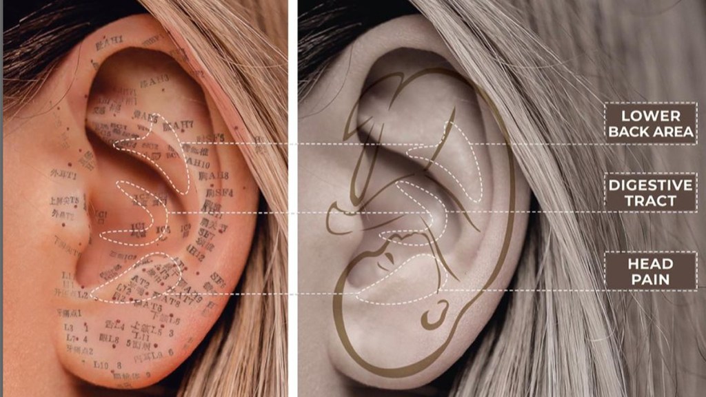 Ear seeds for weight loss: map of ear acupressure points