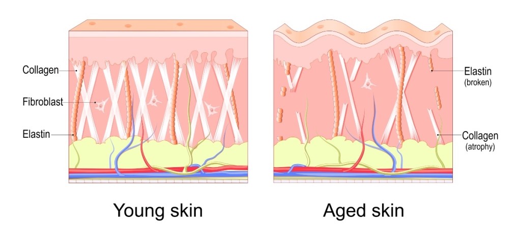 An illustration of collagen in young and old skin