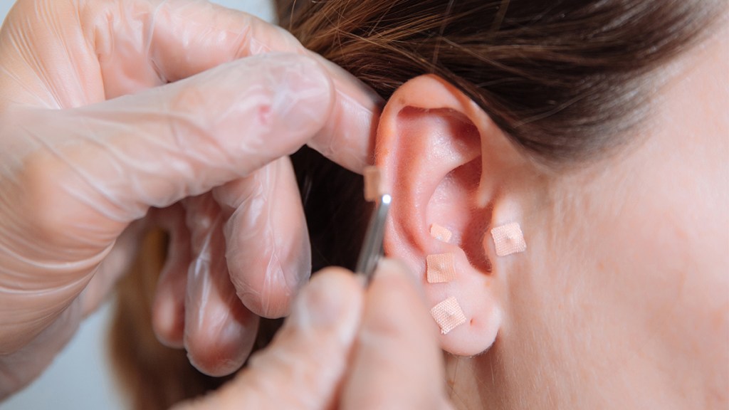 close up of a woman with ear seeds for weight loss