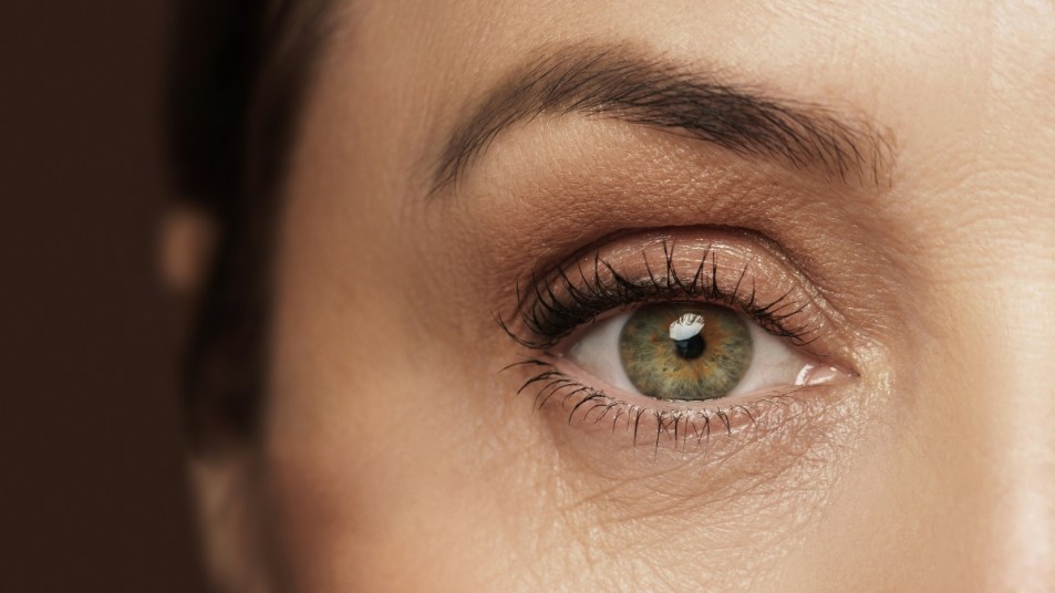 Mature woman close up of eye, how to fix droopy lids without surgery