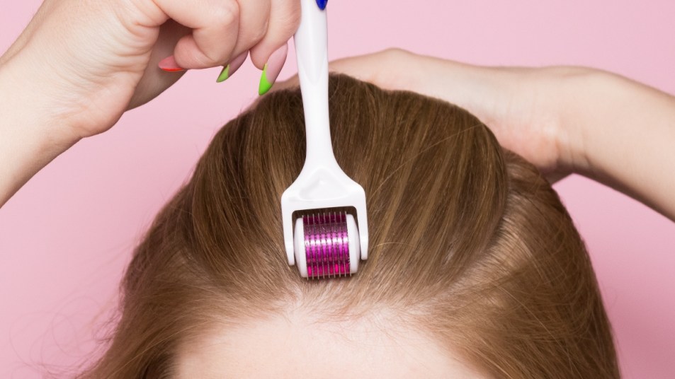 Woman derma rolling scalp and hair for hair growth