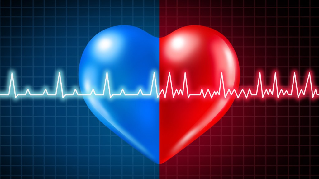 An illustration of an irregular heartbeat caused by atrial fibrillation, which can lead to a silent stroke