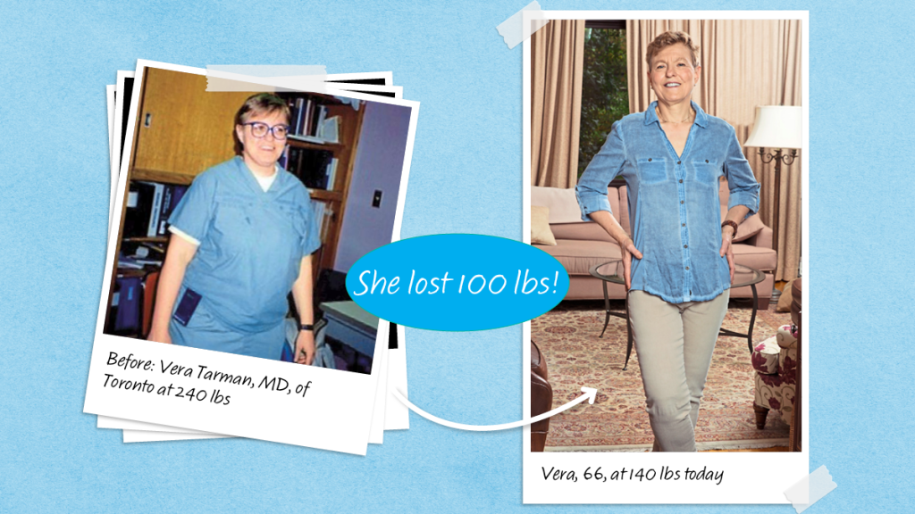 Before and after photos of Vera Tarman who lost 100 lbs after quieting food noise and food addiction